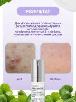 Serul booster cu microace VT Cosmetics Reedle Shot 300 - imagine 4
