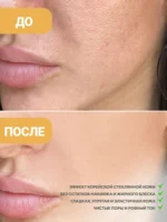 Ulei hidrofil Anua Heartleaf Pore Control Cleansing — изображение 10